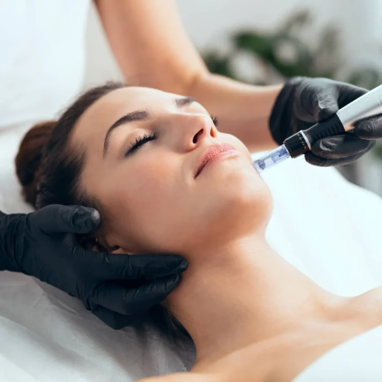 Microneedling_11zon
