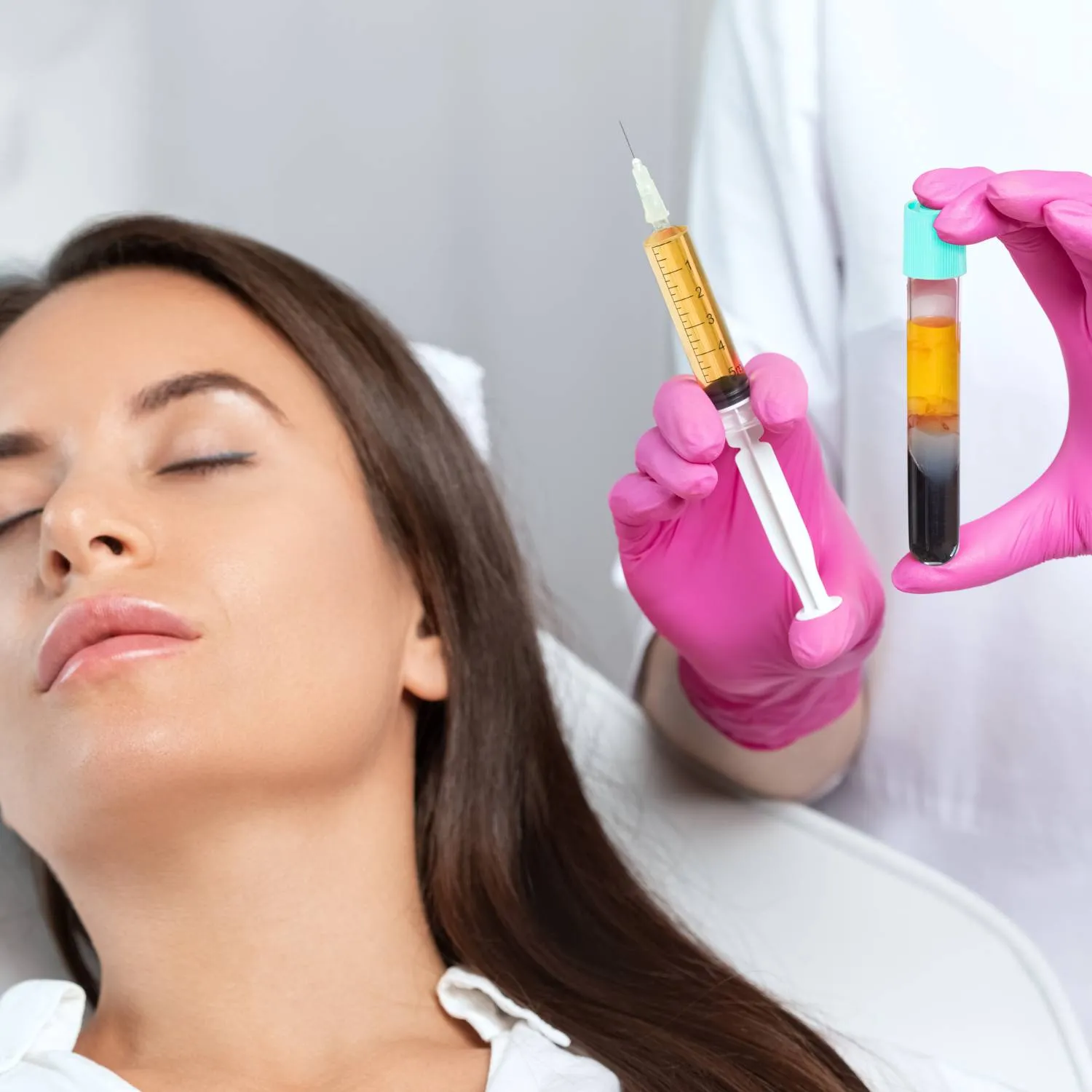 Plasma Rico en Factores de Crecimiento (PRP)